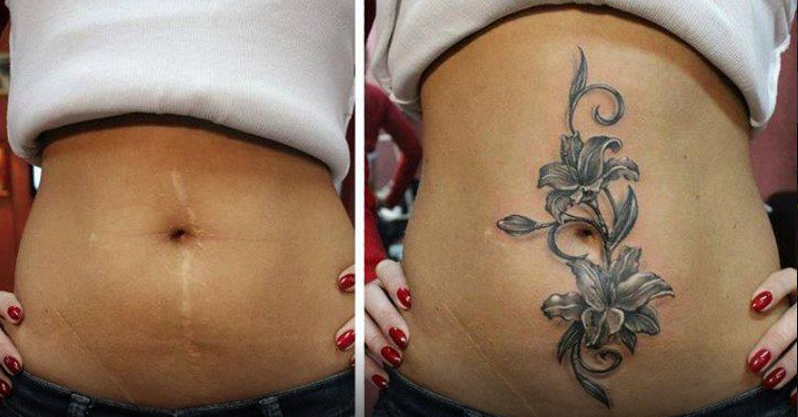 Тату на животе на шраме