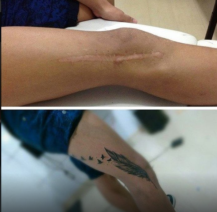 Тату на шраме на ноге