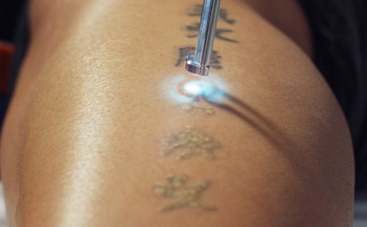 ornamental tattoo: Невероятно простой метод, который работает для всех