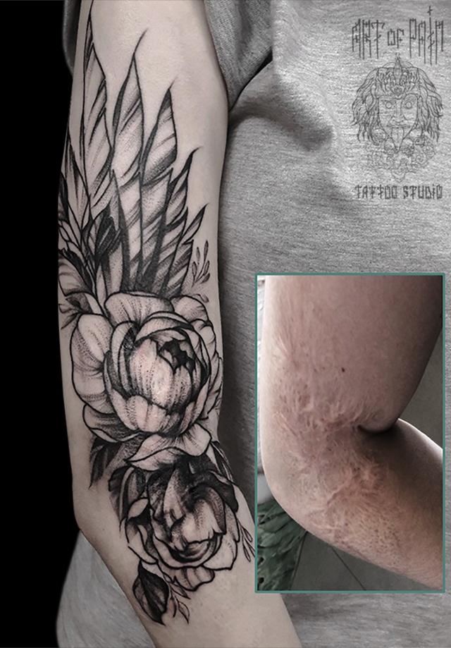 Татуировка женская графика на руке пионы CoverUp – Мастер тату: 